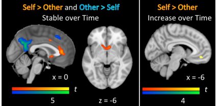 Images show self vs. other responses in brain