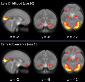 Image shows responses in brain to emotional facial expressions in late childhood and early adolescence