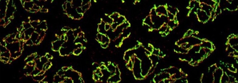 Superresolution imaging of meiotic chromosome structures