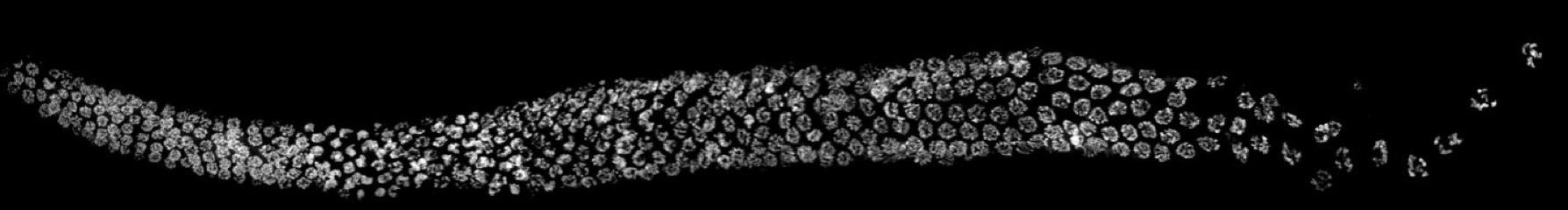 C. elegans germ line (oogenesis) stained with DNA dye DAPI