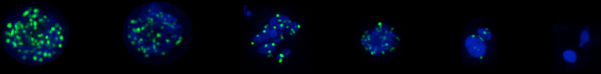 RAD-51 foci in C. elegans spermatocyte
