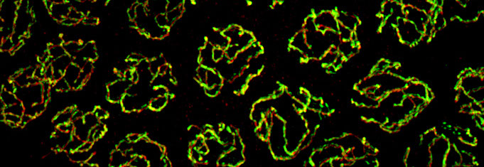 Super resolution imaging of meiotic chromosome structures (synaptonemal complex) in C. elegans germline